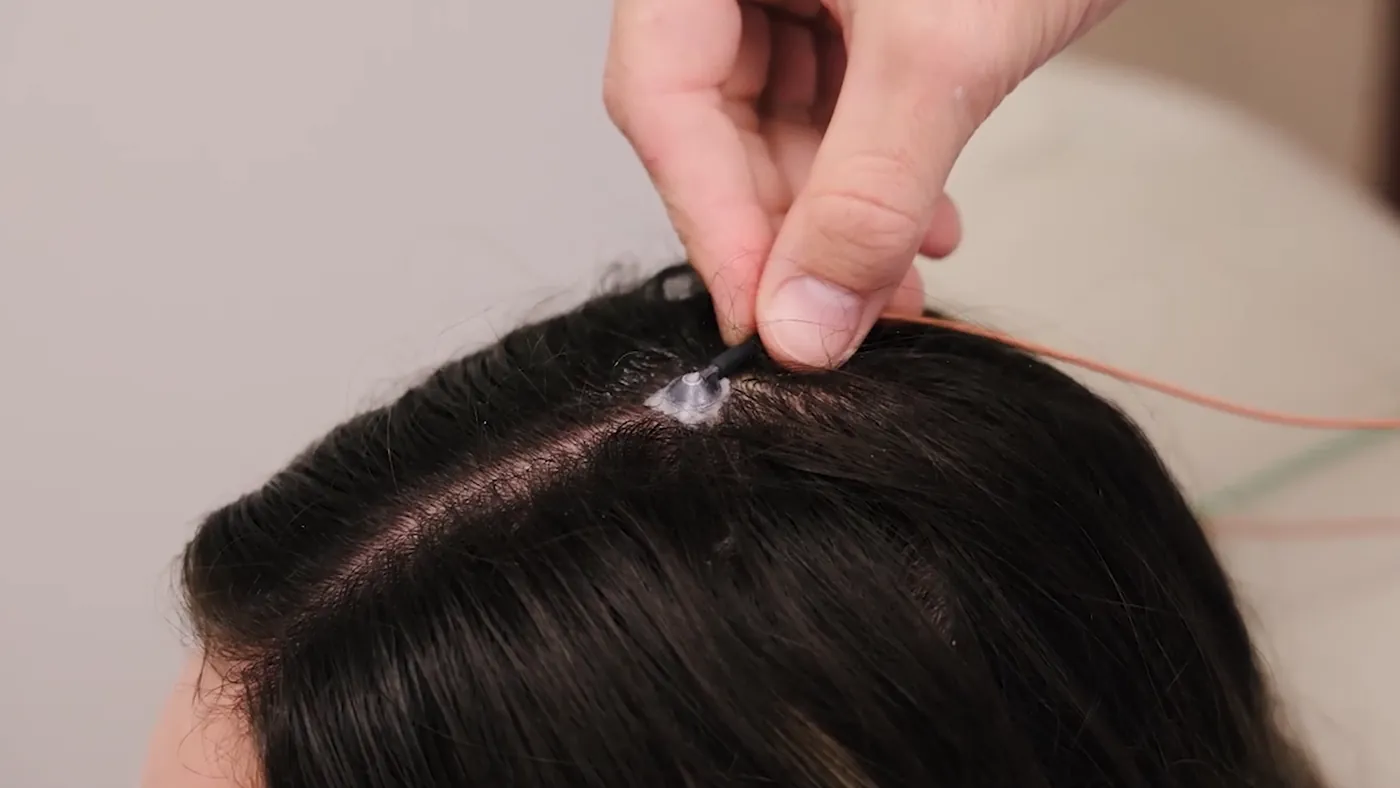 An electrode being placed for a qEEG brain-mapping session